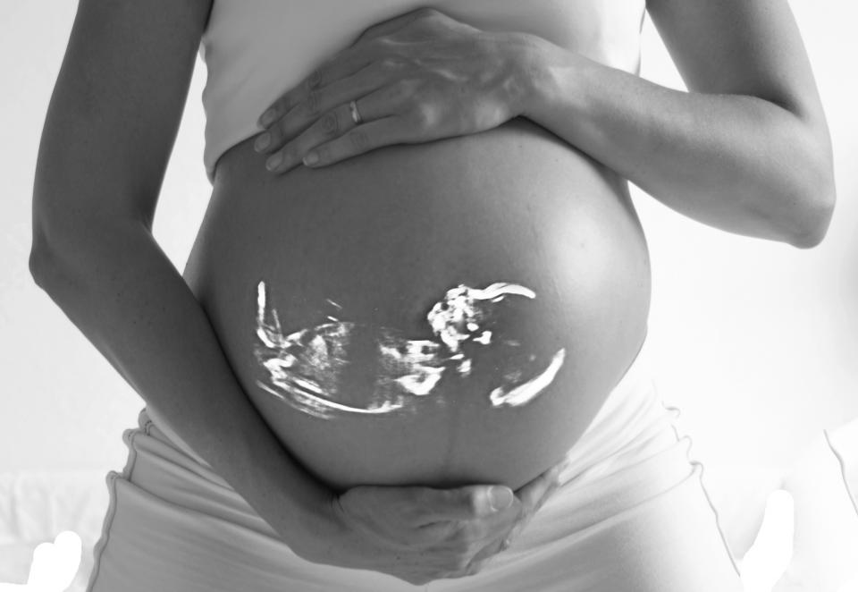 דרישה לפיצוי. אישה בהיריון|צילום: אתר stocksnap.io
